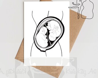 Twins in the belly, double card with envelope without text, print of ink drawing by Krista Kitsz Art.