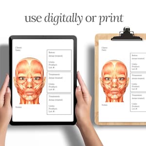 Botox and Dermal Filler Treatment Record - Patient Record, Dermal Filler, Nurse Injector, Injectables Form, Botox Treatment Record