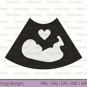 Ultraschall Bild SVG Schwangerschaft Ankündigung Vektor Fötus Bild geschnitten Datei wachsen Baby Clipart Sonogramm Grafik mit Herz fetale Entwicklung