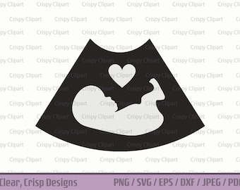 Ultraschall Bild SVG Schwangerschaft Ankündigung Vektor Fötus Bild geschnitten Datei wachsen Baby Clipart Sonogramm Grafik mit Herz fetale Entwicklung