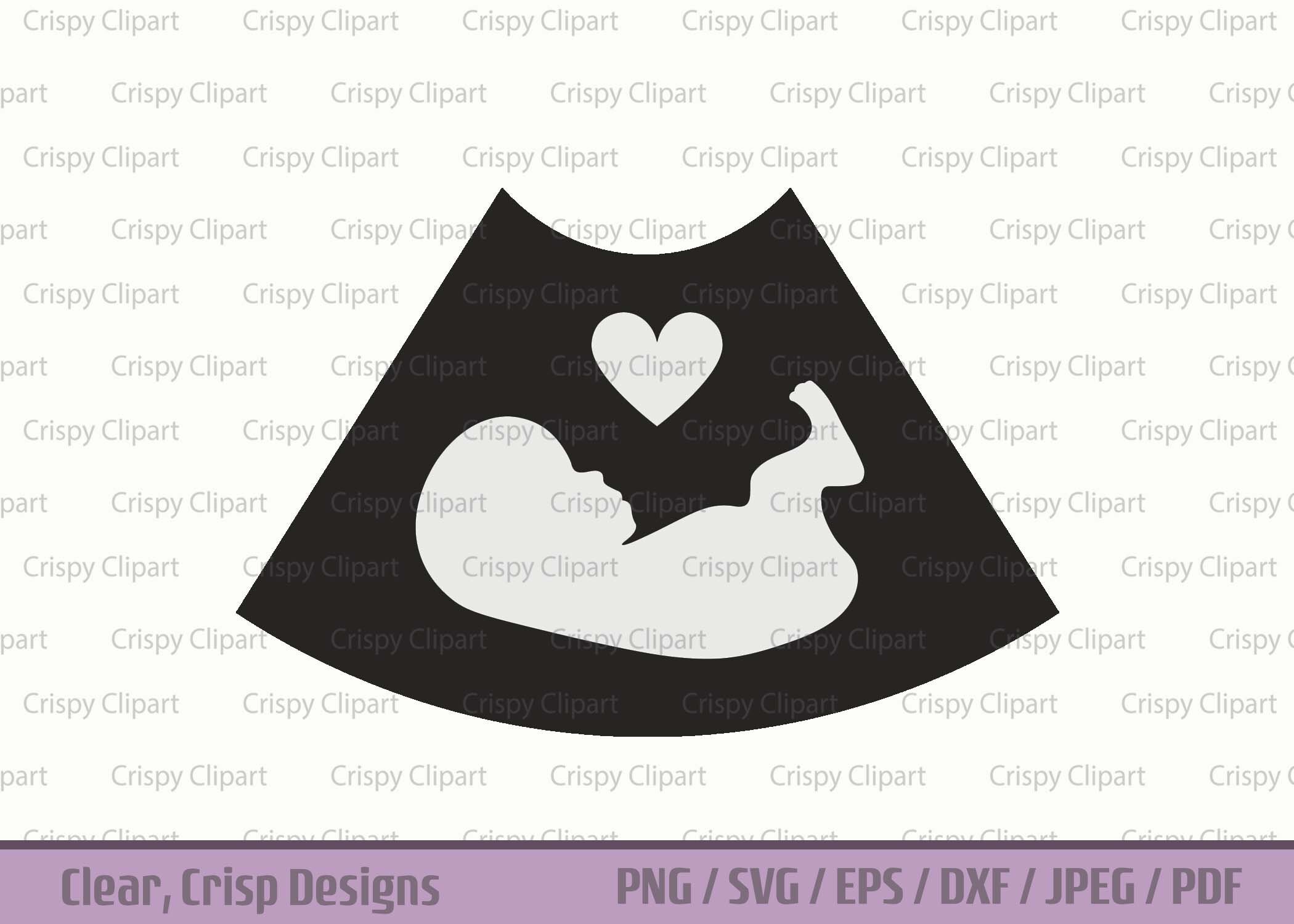ultrasound-clipart