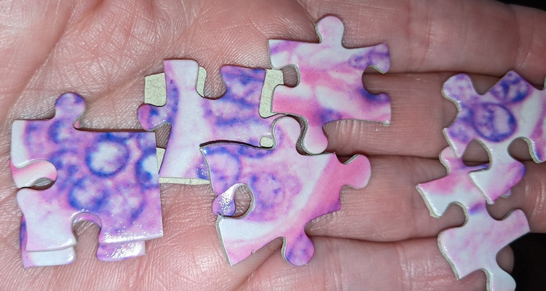 Puzzle Ribbon Variant Basal Cell Tumor From a Dog - Etsy