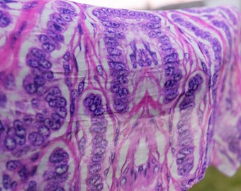 Puzzle Ribbon Variant Basal Cell Tumor From a Dog - Etsy