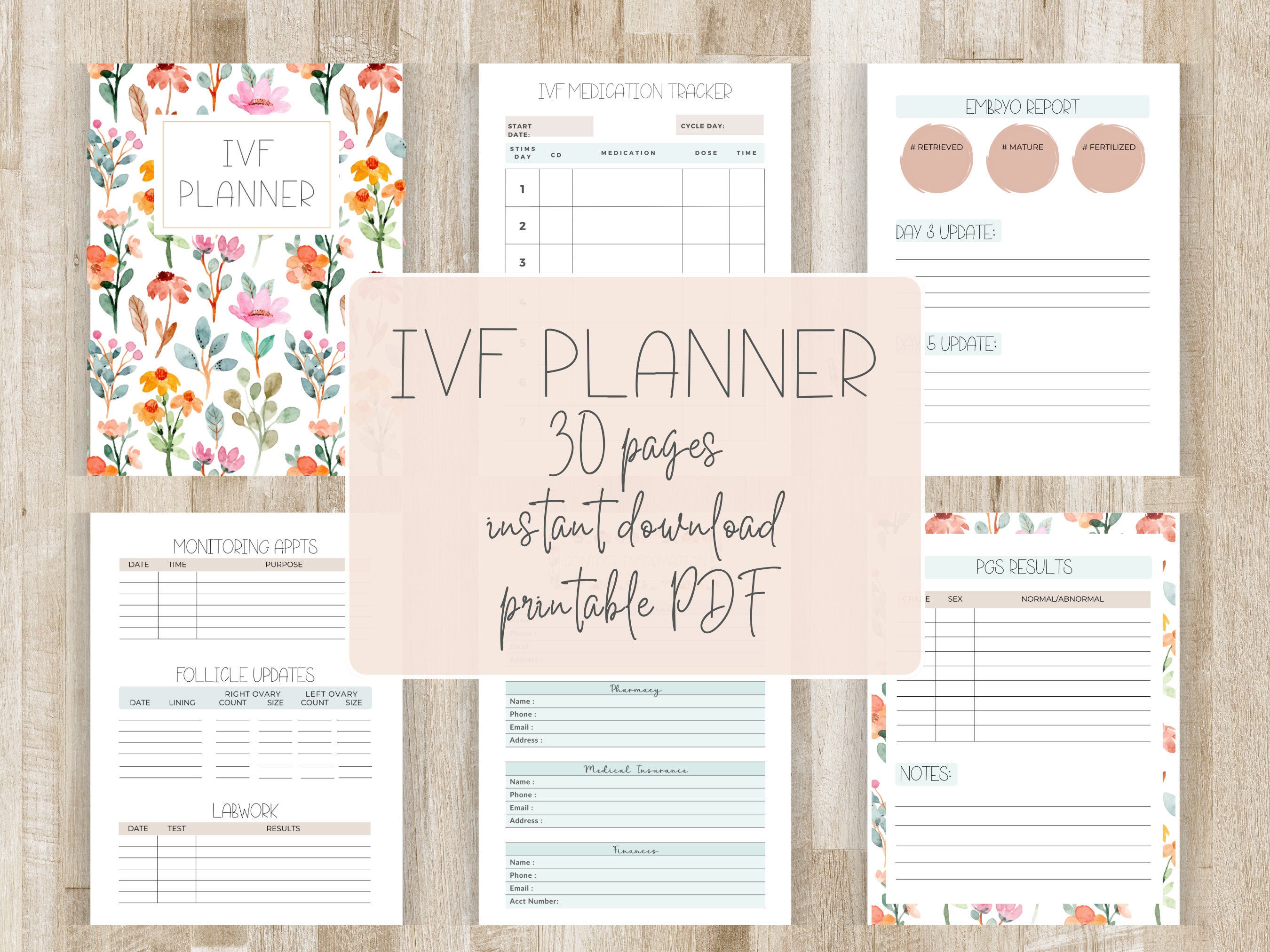 IVF Planner IVF Calendar TTC Planner Fertility Planner Journal ...