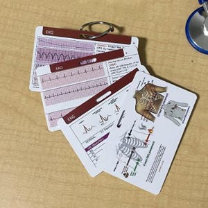 EKG Interpretation Badge Cards: ECG Arrhythmias Cheat Sheet + 12 & 5 ekg lead placement, ekg reading tip