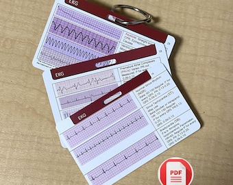 EKG Rhythm Badge Cards, ECG Interpretation Study Guide (PDF)