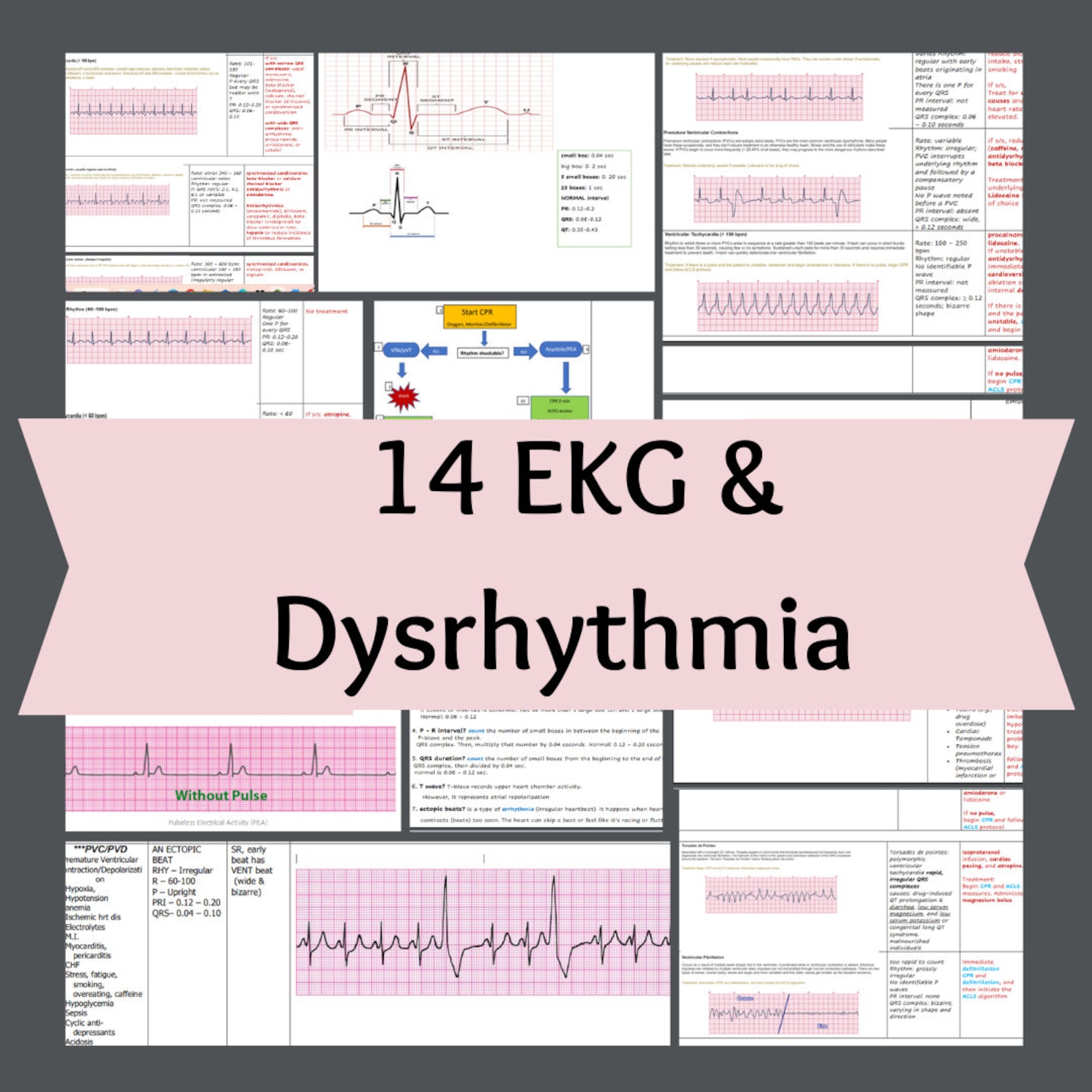 Cardiac Ekg Interpretation Nursing School Student RN Ecg & Dysrhythmias ...