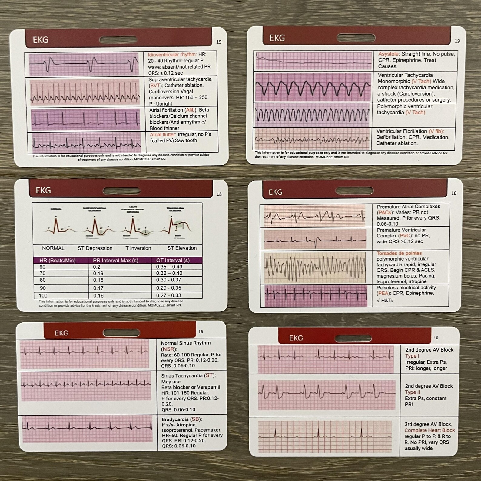 Rhythm Engineering Code Green ACLS Code Blue Badge Card: EKG Rhythms Cheat Sheet (PDF) - Etsy
