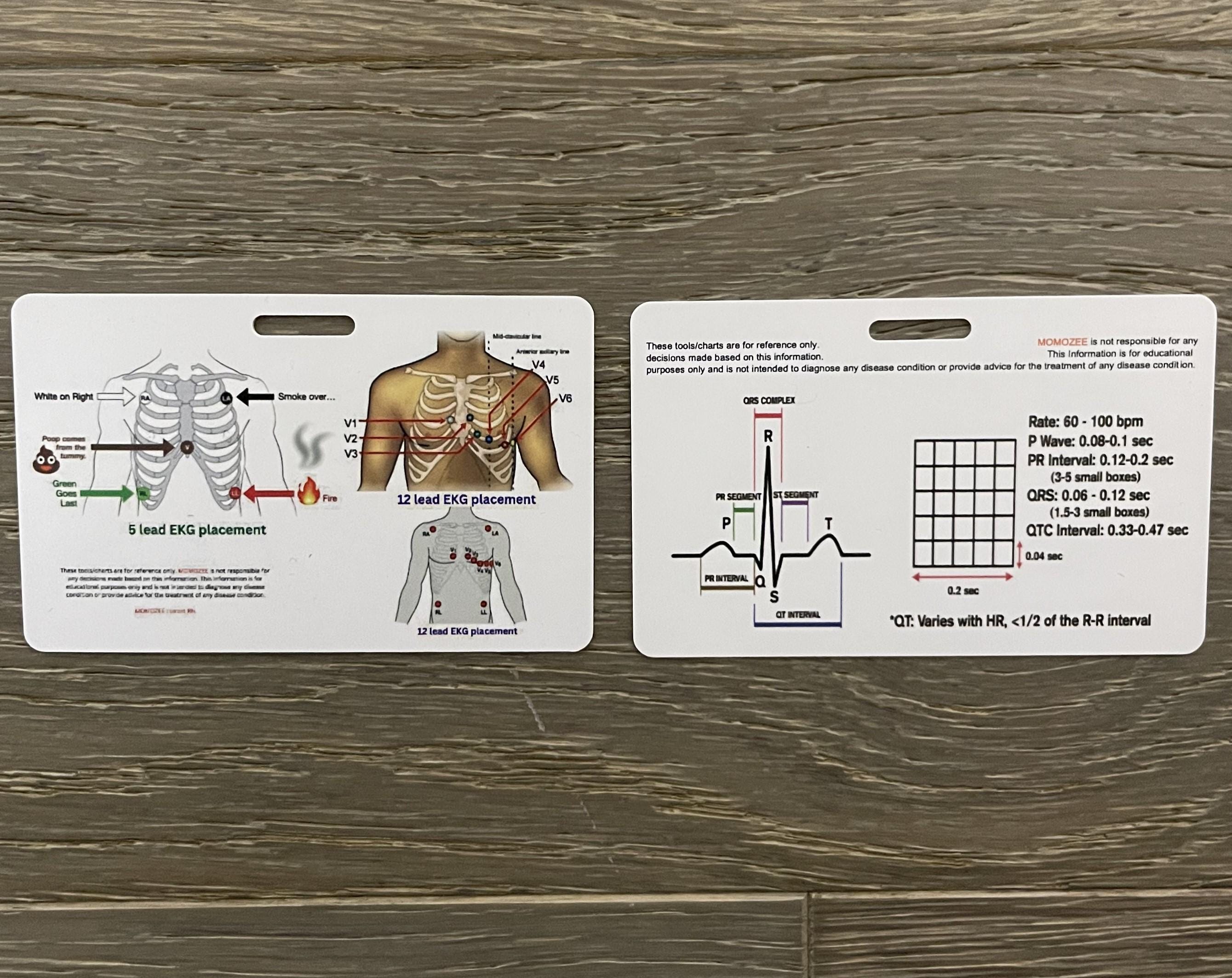 ACLS Code Blue Badge Card: EKG Rhythms Cheat Sheet (PDF) - Etsy