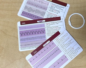 EKG Rhythm Badge Cards, ECG Interpretation Study Guide (PDF)