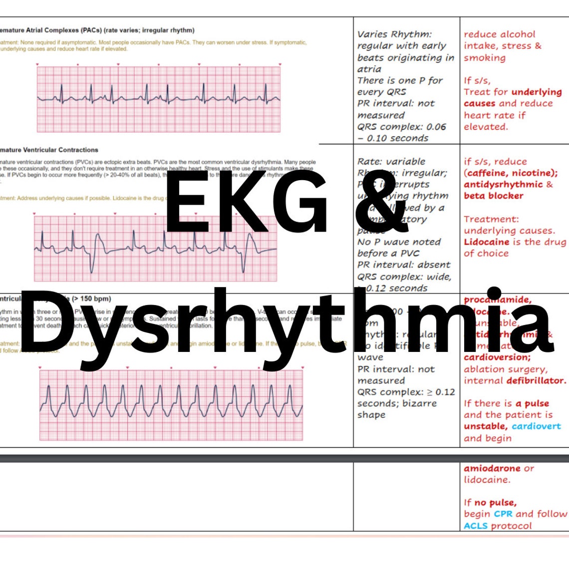 Cardiac Ekg Interpretation Nursing School Student RN Ecg & Dysrhythmias ...
