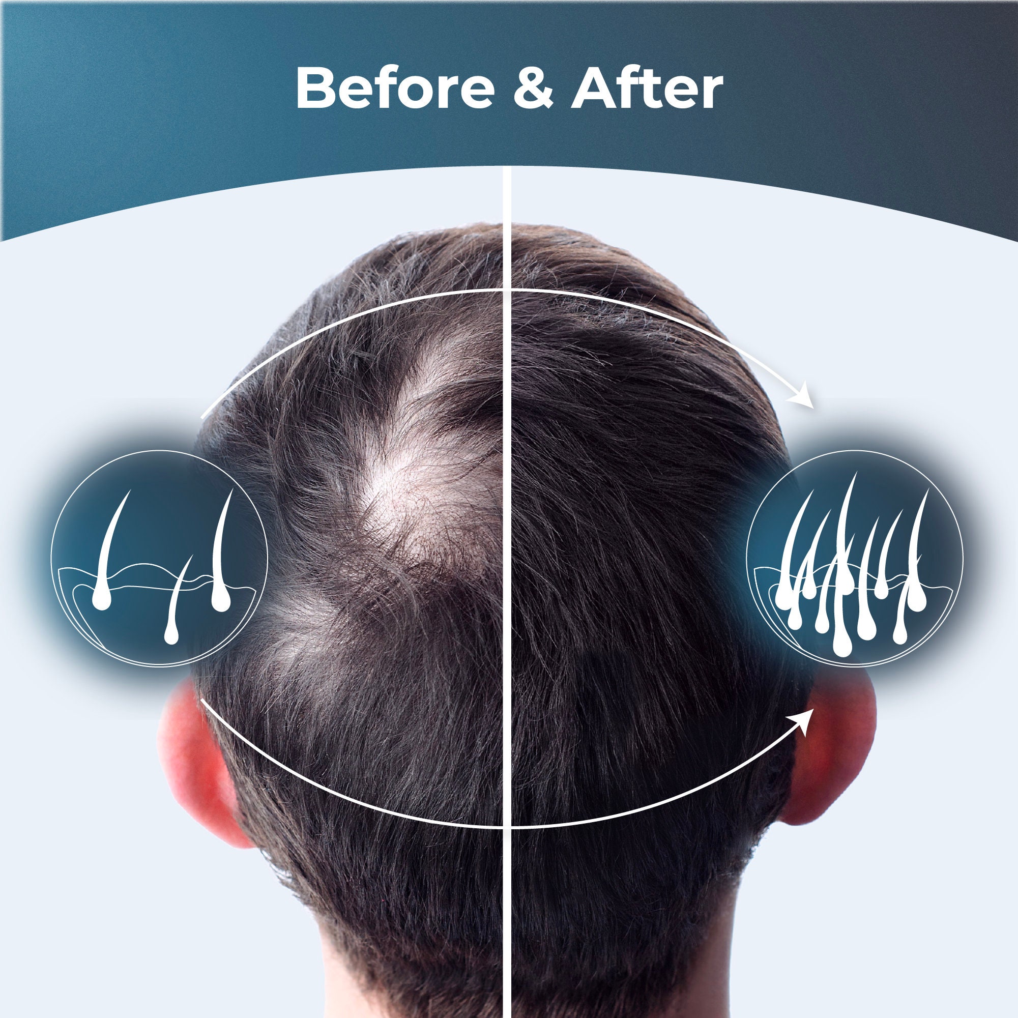 Regrow Hair Growth Formula, Hair Vitamins With Biotin and Saw Palmetto