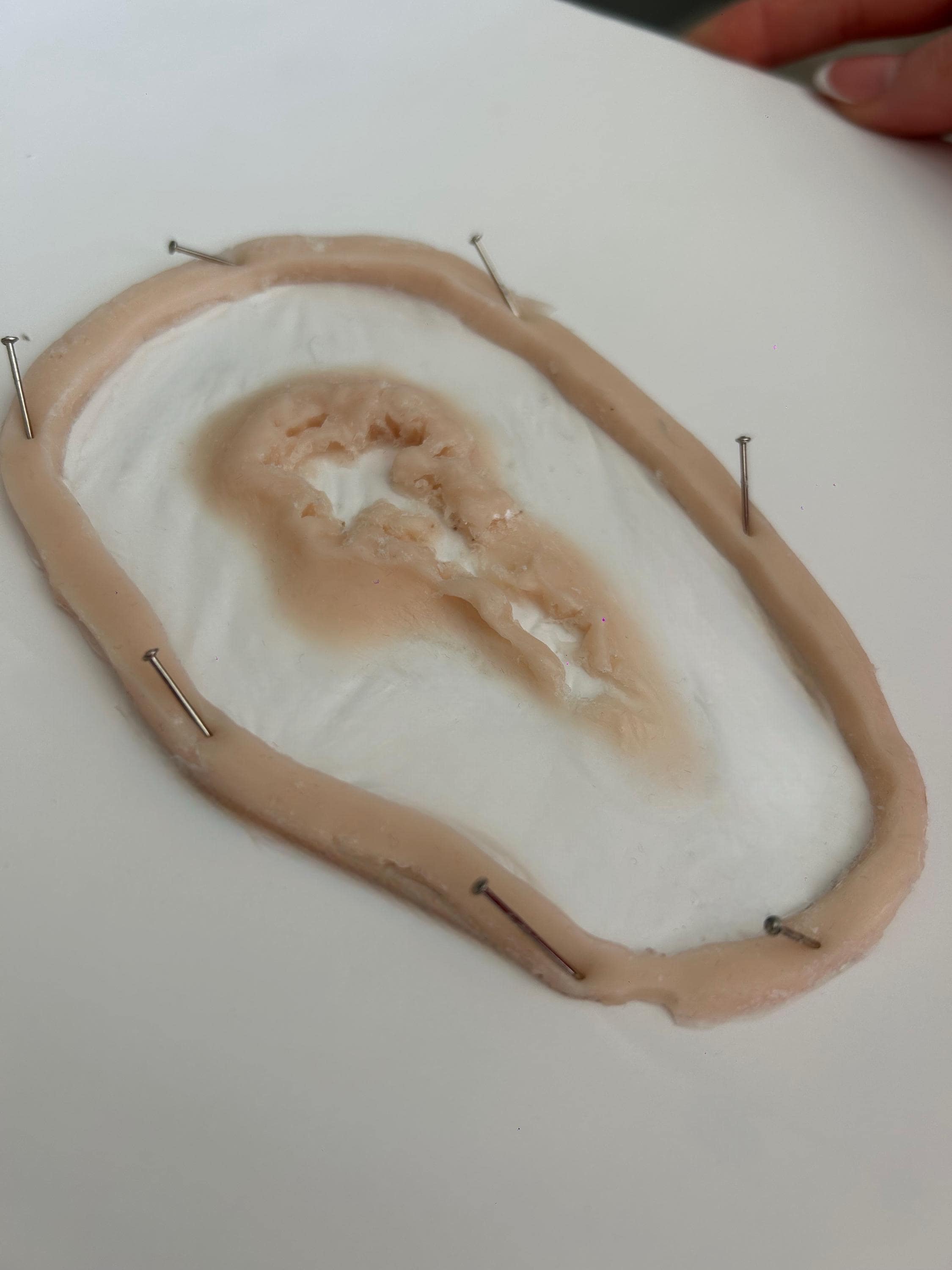 Seksuele problemen, image size:2250x3000