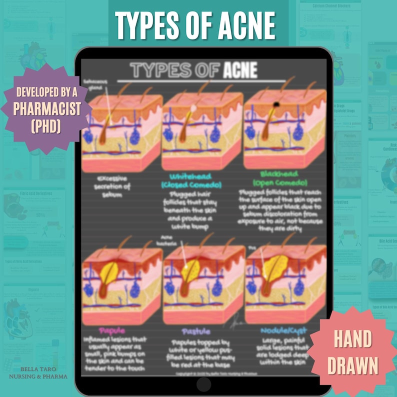 Hand-drawn Acne Types Diagram: Esthetician Skin Anatomy | Skin Anatomy ...