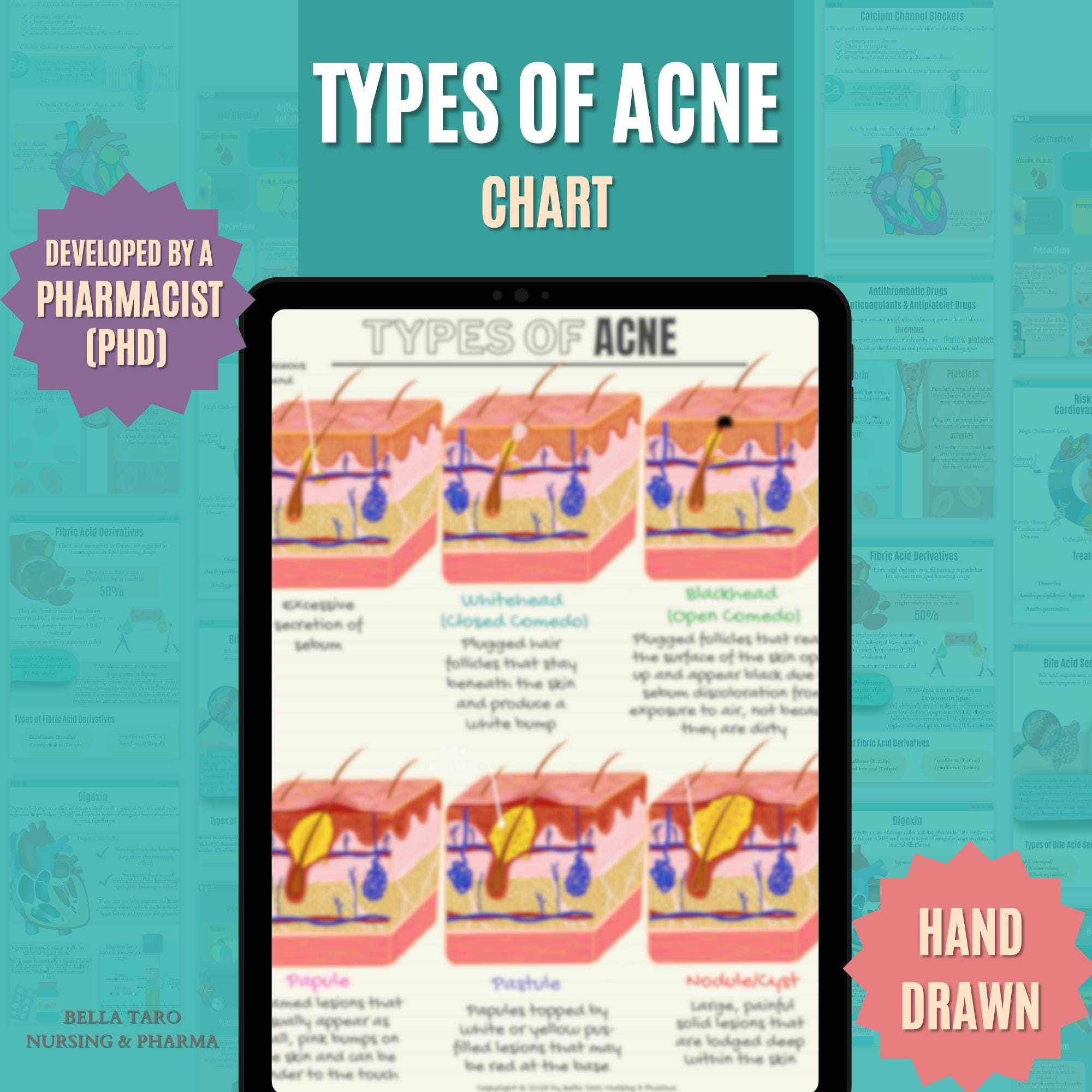 Hand-drawn Acne Types Diagram: Esthetician Skin Anatomy | Skin Anatomy ...