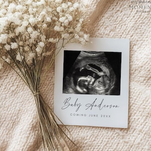 Puede incluir: Una tarjeta blanca con una imagen de ultrasonido y el texto "Baby Anderson COMING JUNE 20XX". Un ramo de flores blancas está atado con hilo y colocado junto a la tarjeta. El fondo es una tela de punto color crema.