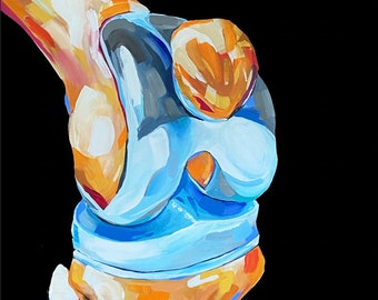 Total Knee Quality Paper PRINT
