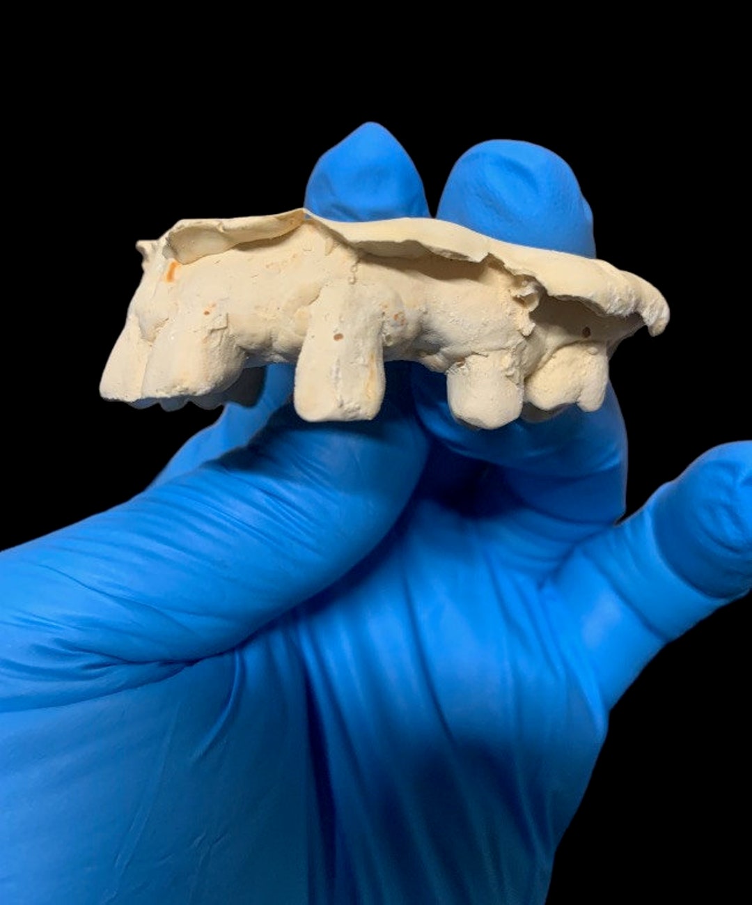 Missing Teeth Grillz Etsy