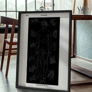 May include: Black and white anatomical diagram of a human body with various symbols and lines connecting to different parts of the body. The diagram is titled "DIAGRAM No. 3" and is framed in a black frame.