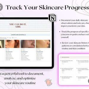 May include: A screenshot of a computer screen showing a skincare journal website. The website has a section for tracking skin observations and a section for documenting daily skincare routines. The text on the screen reads "You can do it, girl." and "Skincare Journal."