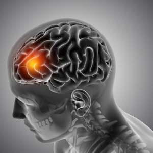 May include: A 3D medical illustration of a human head with a highlighted area of the brain. The brain is shown in grayscale, with a bright orange area indicating a possible injury or abnormality.