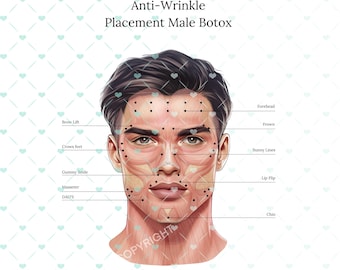 Botox Injection Points on Muscle Anatomy | Botox & Filler Injector ...