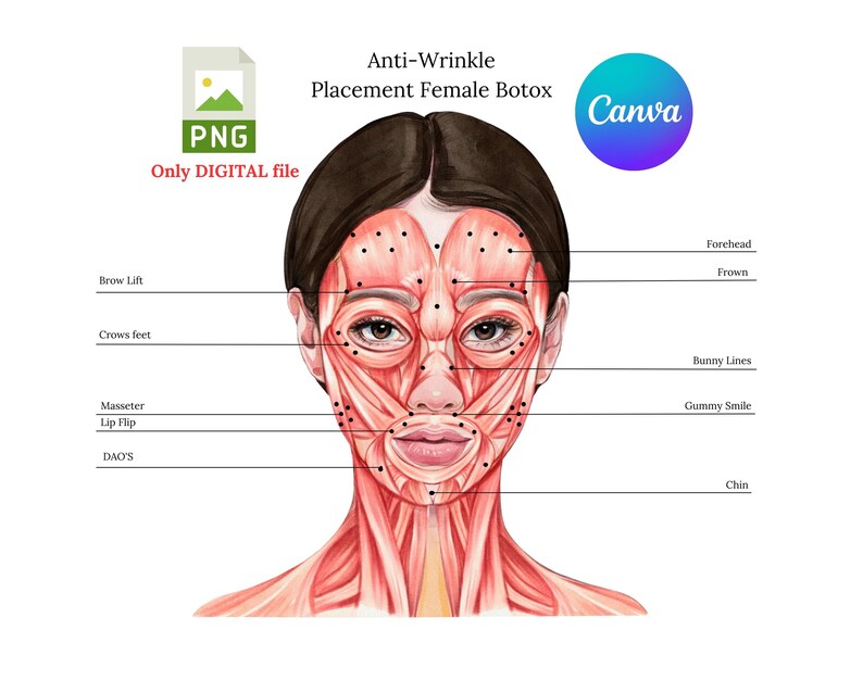 Botox Injection Points on Muscle Anatomy PNG| Botox & Filler Injector ...