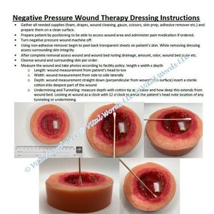 Negative Pressure Wound Therapy Instructions with Photos (Simplified Version)