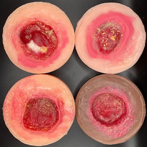 SET (4 pieces): Pressure Injury Models for Wound Care Education