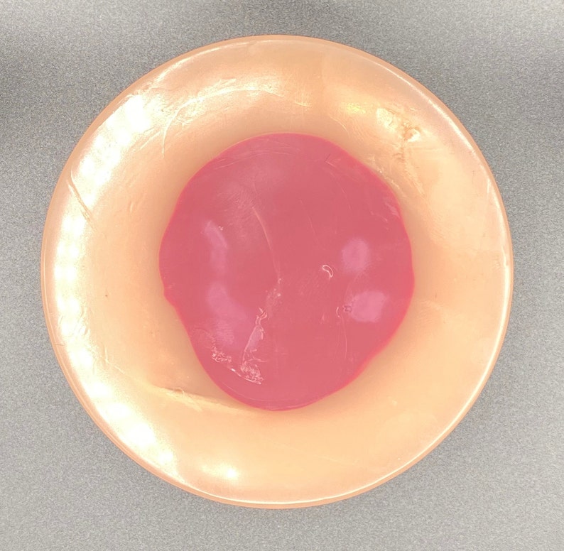 Pressure Injury Deep Tissue DTI Model for Wound Care Etsy