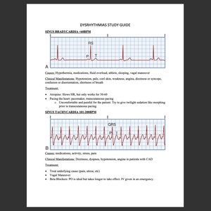 21-Page Comprehensive Cardiac Care and Dysrhythmias Study Guide; Critical, Emergency, & Cardiac Care, Nursing School Study Guide, PDF
