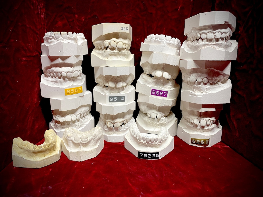 Vintage Dental Plaster Teeth Mold Etsy