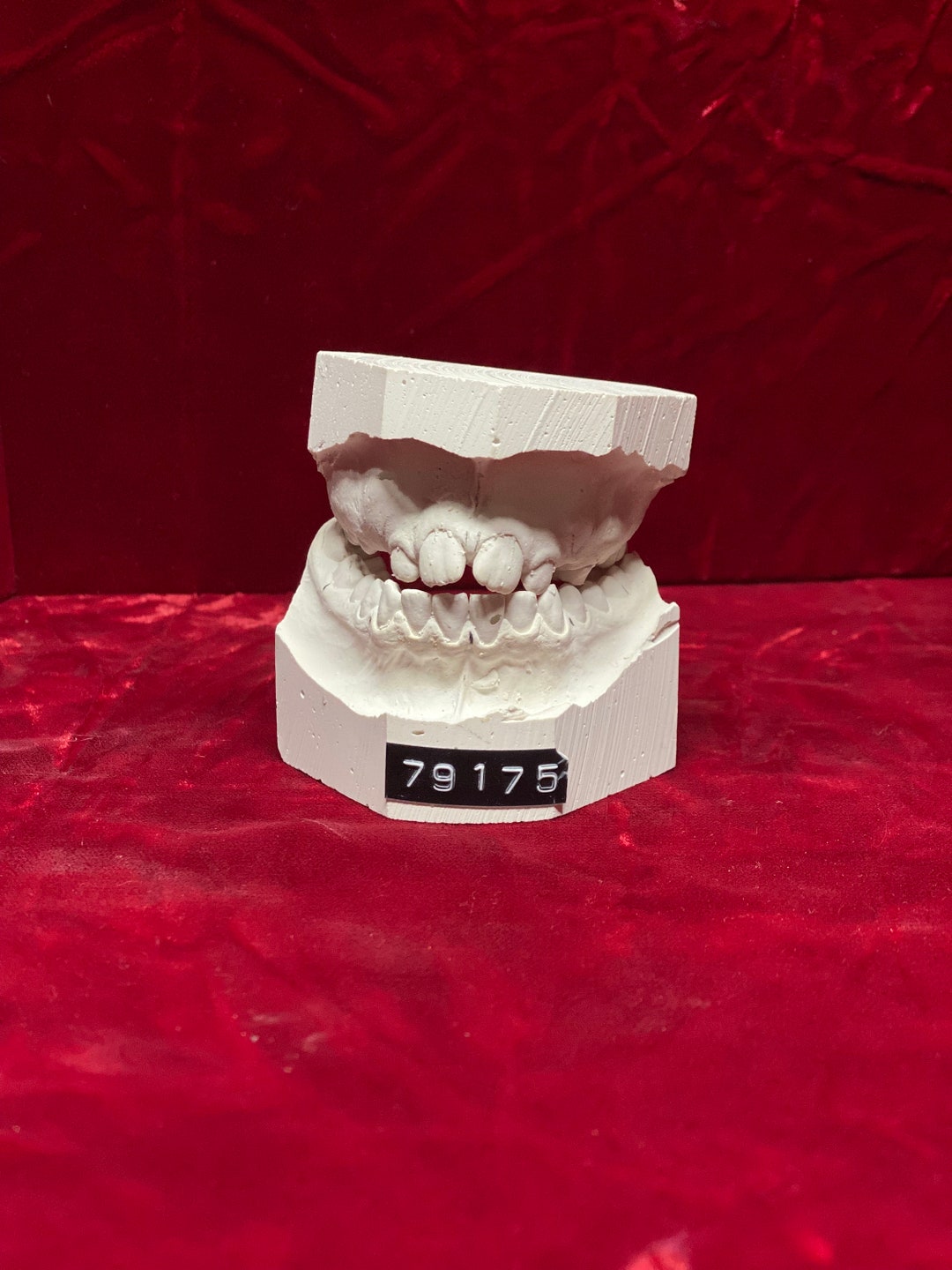 Vintage Dental Plaster Teeth Mold Set Patient melissa From Etsy