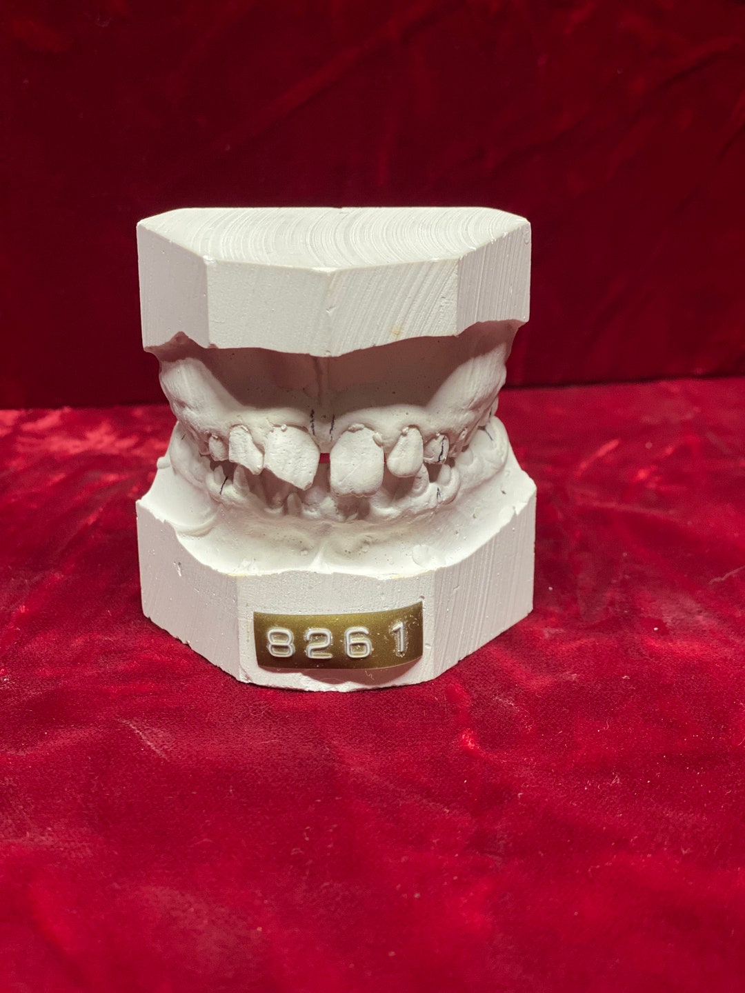 Vintage Dental Plaster Teeth Mold Set Patient robert From Etsy