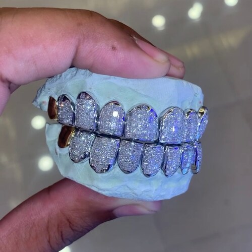 Real Solid Gold Grillz Custom Gold Jewelry Gold Teeth Etsy