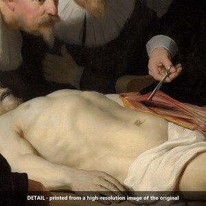 May include: A detailed oil painting reproduction showing a pale, recumbent figure with a white cloth draped over the lower body. A hand holds surgical scissors over an exposed forearm, while observers in dark clothing with white ruffs look on.