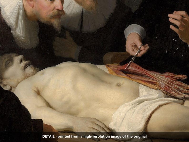 May include: A detailed oil painting reproduction showing a pale, recumbent figure with a white cloth draped over the lower body. A hand holds surgical scissors over an exposed forearm, while observers in dark clothing with white ruffs look on.