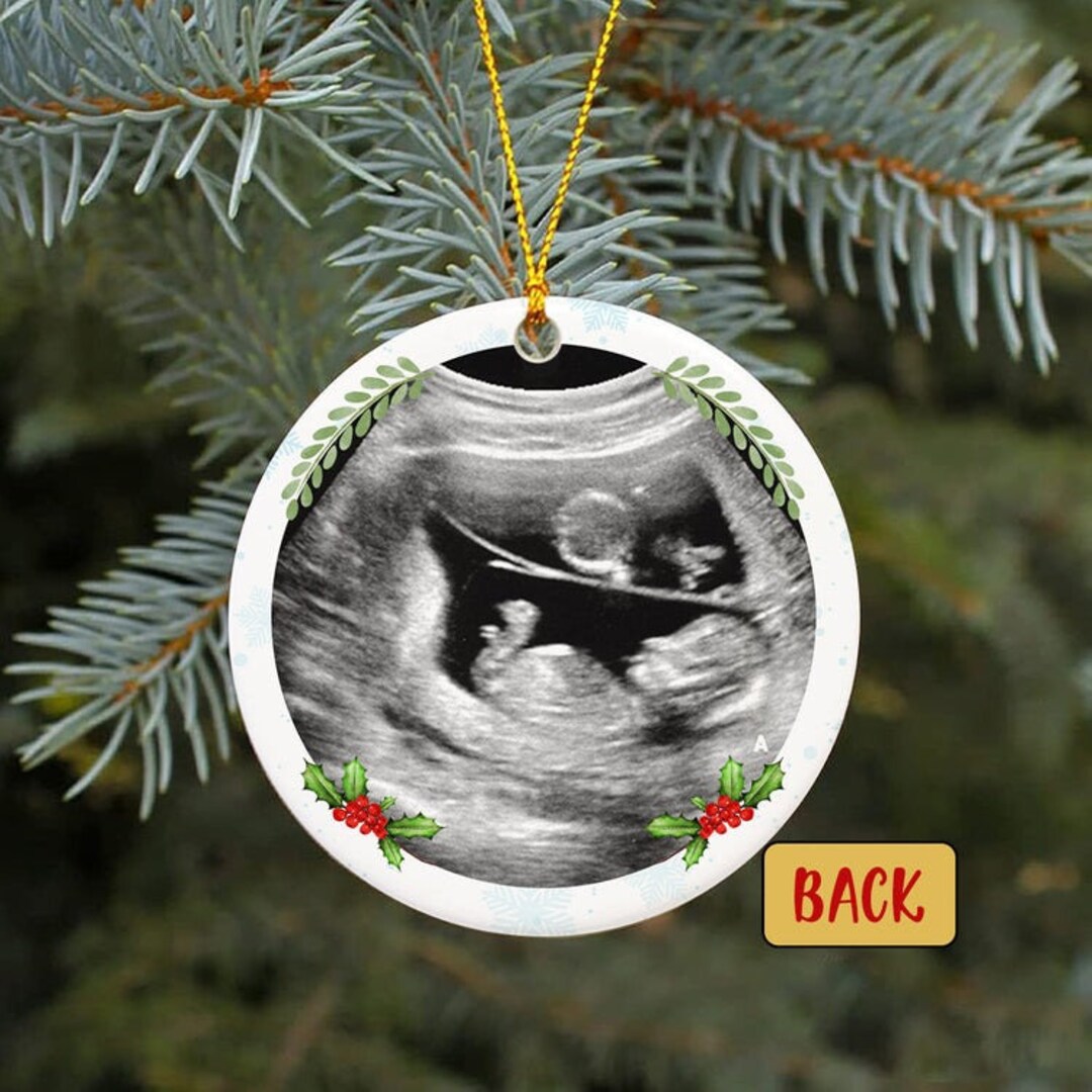 Ultrasound Christmas Ornament 