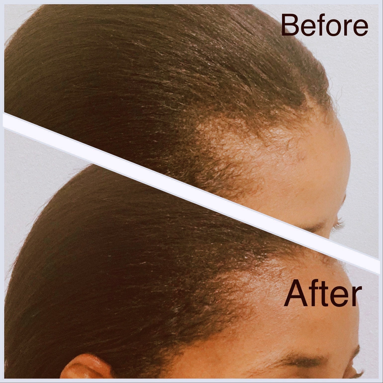 Share more than 150 can caffeine cause hair loss super hot POPPY