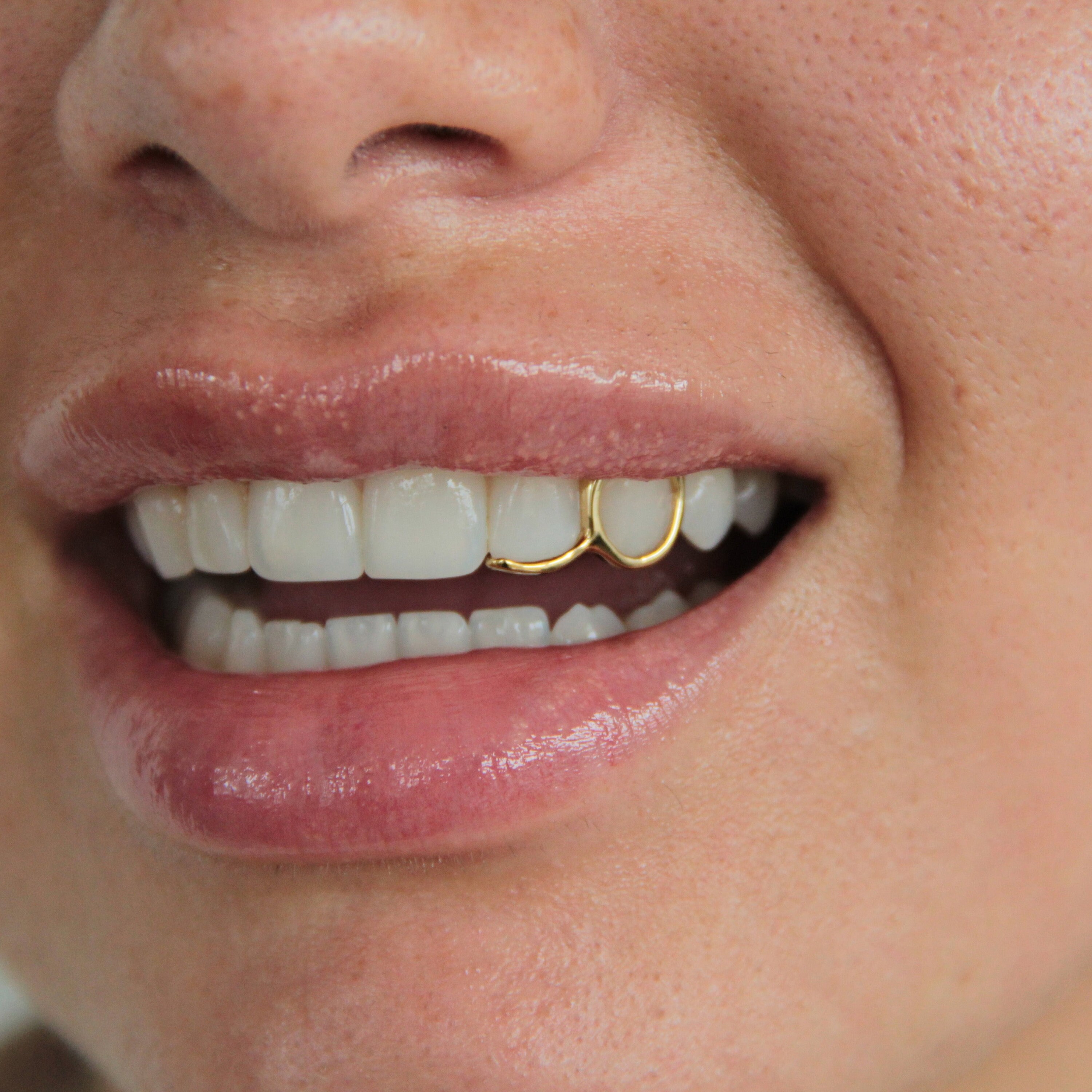 Single Gold Tooth Cap Single Gold Tooth Cap