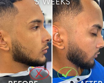 Accelerate Hair Growth - 3 Month Supply - Visible Results