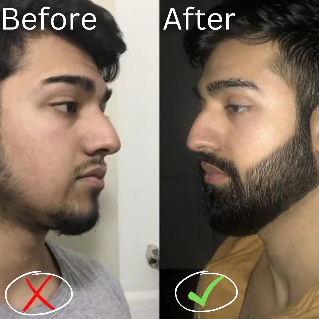 Beard Growth Serum 30ml Bottle Etsy