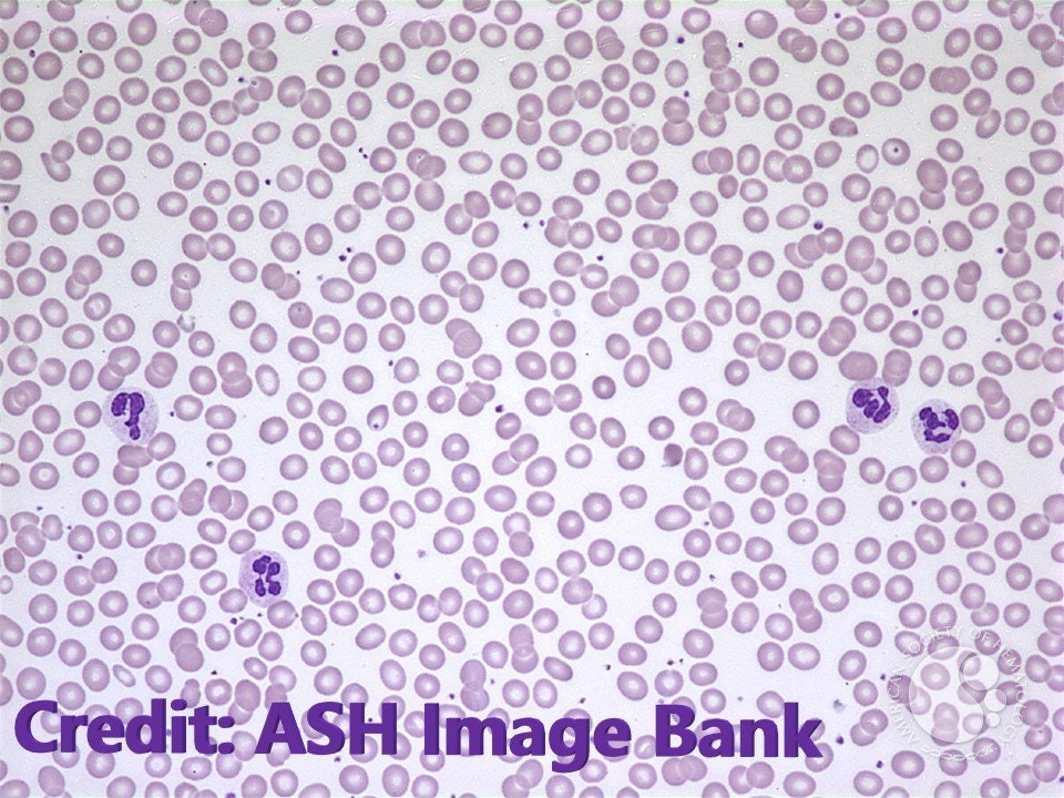 Red Blood Cell Sticker, Haematology Stickers, Pathology Stickers ...