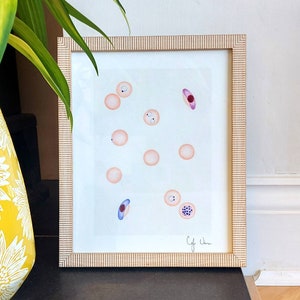 Malaria (Plasmodium falciparum) Art Giclée print, haematology cell art, microbiology, biomedical, blood cell art, haematology gift, parasite