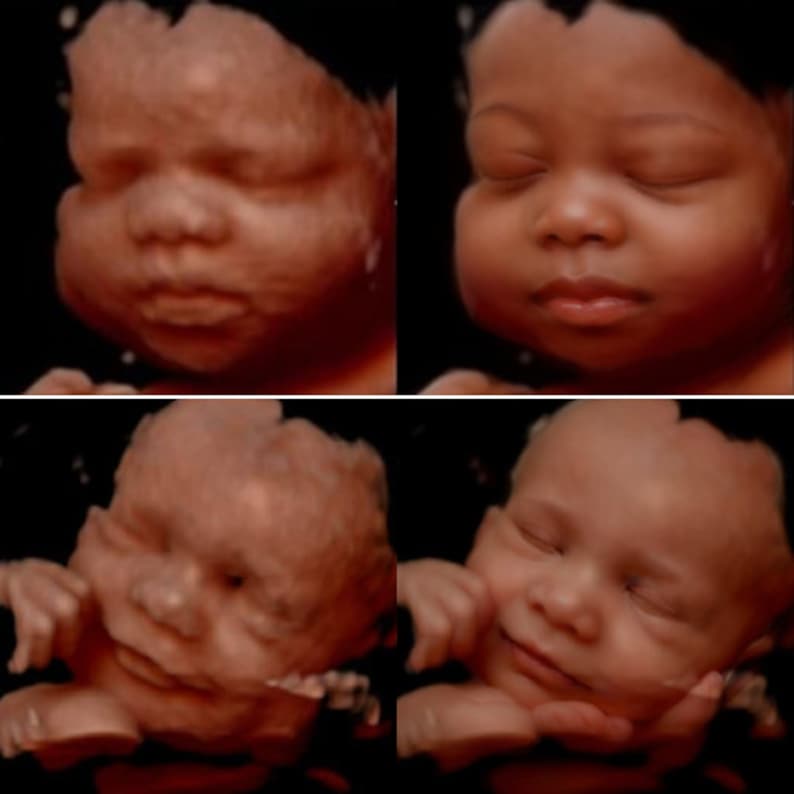 3D, 4D, 5D and HD Ultrasound. Turn your ultrasound into a REALISTIC ultrasound with your baby's face, HD ultrasound gift Ultrasound image 4