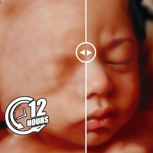 May include: A side-by-side comparison of a baby's face before and after 12 hours. The left side shows the baby's face with a blurry, reddish hue. The right side shows the baby's face with a clear, natural skin tone. A clock icon with the text "12 HOURS" is visible on the left side of the image.