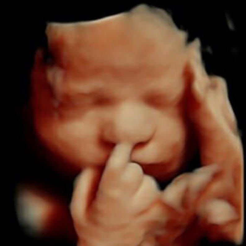 3D, 4D, 5D and HD Ultrasound. Turn your ultrasound into a REALISTIC ultrasound with your baby's face, HD ultrasound gift Ultrasound image 6