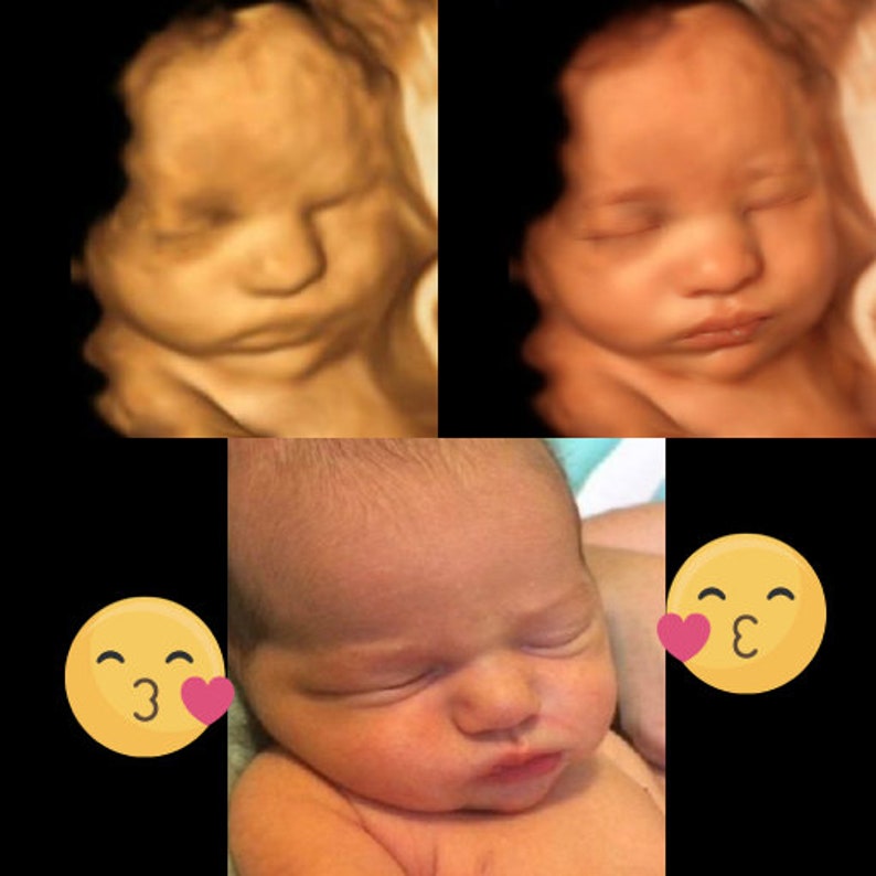 3D, 4D, 5D and HD Ultrasound. Turn your ultrasound into a REALISTIC ultrasound with your baby's face, HD ultrasound gift Ultrasound image 5