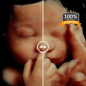 3D, 4D, 5D and HD Ultrasound. Turn your ultrasound into a REALISTIC ultrasound with your baby's face, HD ultrasound gift Ultrasound image 1