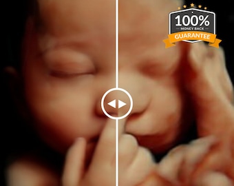 3D, 4D, 5D en HD-echografie. Verander uw echo in een REALISTISCHE echo met het gezichtje van uw baby, een HD-echografie cadeau! Echografie